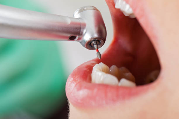 Best Emergency Broken Tooth Repair in Jeffersonville, OH
